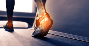 Can Footwear Choices Impact Equinus Deformity 1 Sole Foot and Ankle, Valparaiso, Indiana