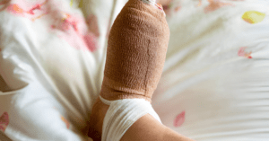 Is Bunion Surgery an Outpatient Procedure Sole Foot and Ankle ,Valparaiso, Indiana
