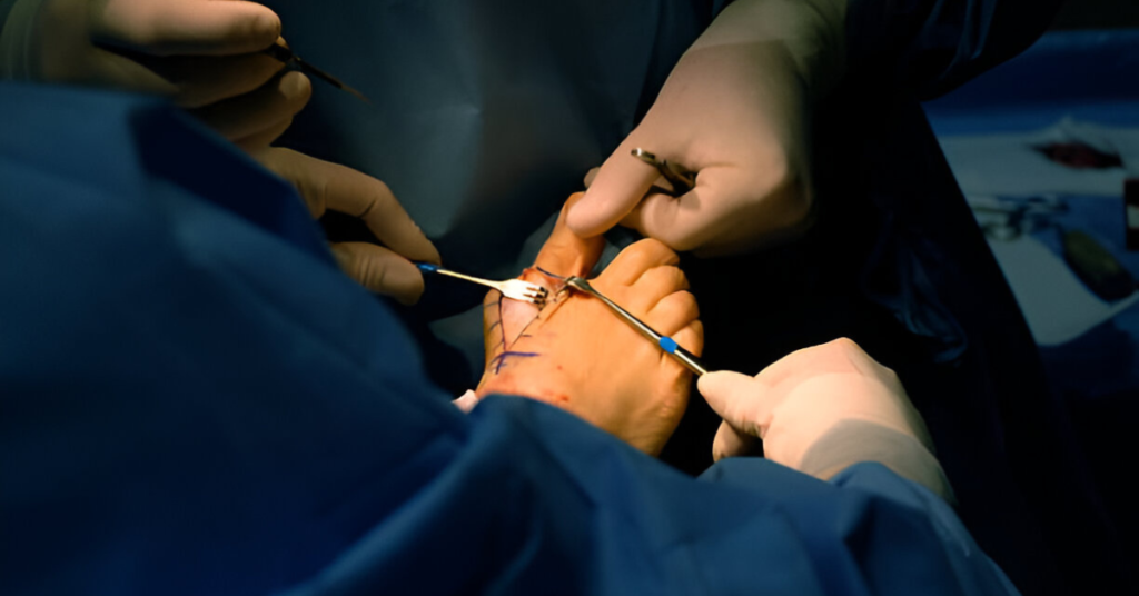 What Kind Of Foot Surgery Are There Sole Foot and Ankle Sole Foot Doc Podiatrist Valparaiso IN