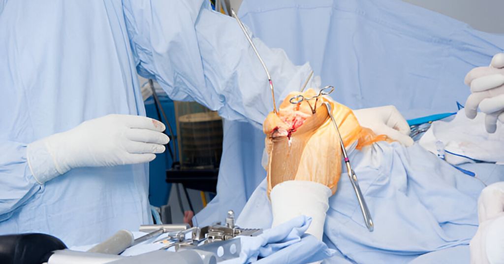 What Is Arthrodesis Surgery and How Does It Work Sole Foot and Ankle Sole Foot Doc foot doctor in Podiatrist Valparaiso IN