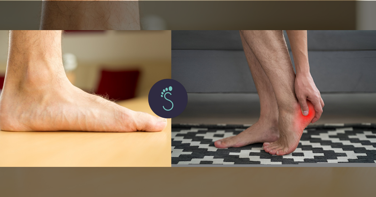 Can Flat Feet Cause Plantar Fasciitis?
