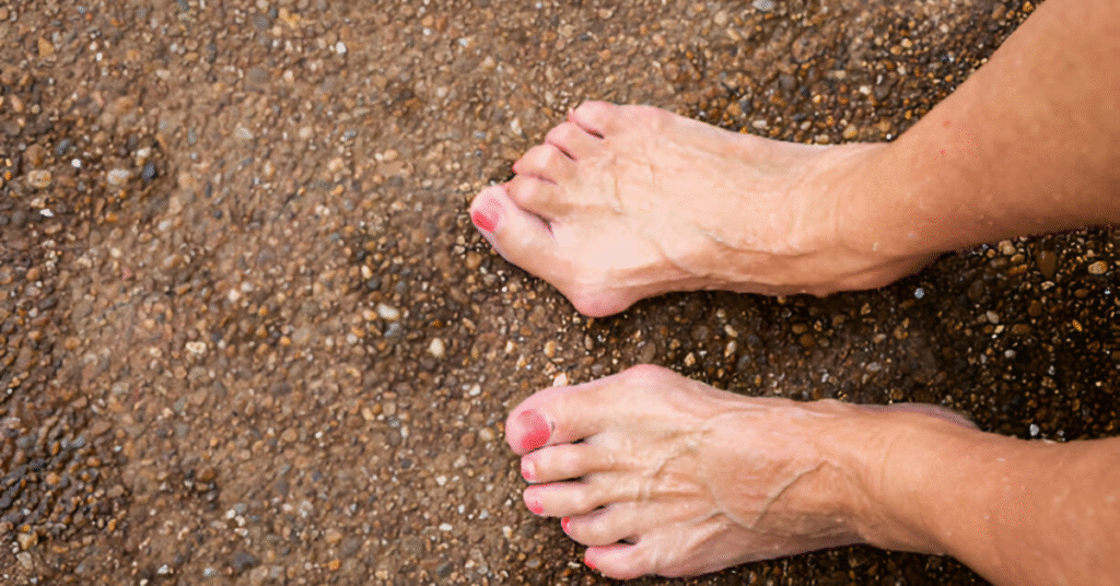 What Causes Hammertoes in Women Sole Foot and Ankle Sole Foot Doc foot doctor in Podiatrist Valparaiso IN Valparaiso podiatrist podiatrist Valparaiso Indiana podiatrist Valparaiso