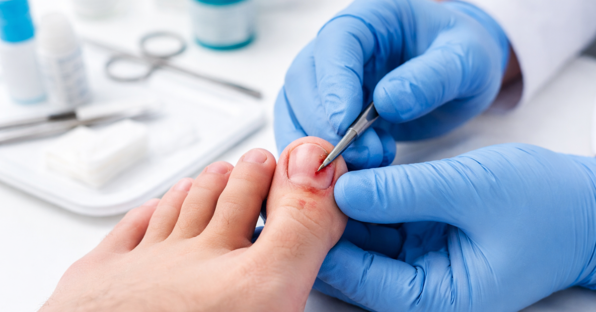 Can an Ingrown Toenail Kill You Sole Foot and Ankle Valparaiso Sole Foot Doc foot doctor in Podiatrist Valparaiso IN Valparaiso podiatrist podiatrist Valparaiso Indiana podiatrist Valpara