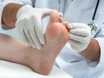 Hammertoe correction Valparaiso, bent toe treatment, toe deformity relief, Sole Foot and Ankle hammertoe care, non-surgical toe alignment, orthopedic foot devices