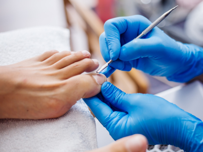 Ingrown toenail removal Valparaiso, painful nail treatment, permanent ingrown nail solution, Sole Foot and Ankle nail care, infected toenail relief, quick nail procedure, ingrown toenail treatment