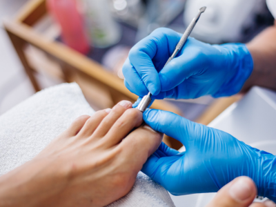 toenail fungus treatment Valparaiso, laser fungal nail therapy, clear nails Indiana, Sole Foot and Ankle yellow nail relief, thick toenail treatment, anti-fungal foot care