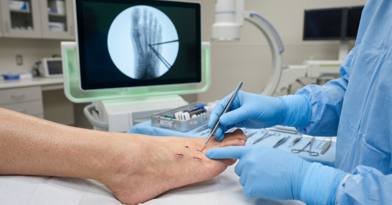 How Minimally Invasive Surgery Supports Limb Salvage