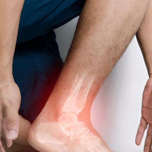 Arthritis Causes, Symptoms, Types & Treatment Sole Foot and Ankle Sole Foot Doc foot doctor in Podiatrist Valparaiso IN