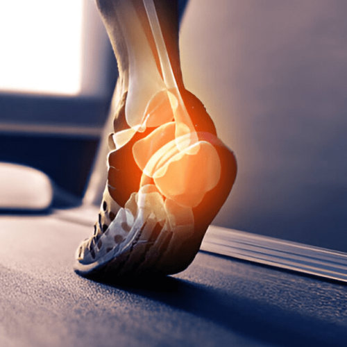 Can Footwear Choices Impact Equinus Deformity 1 Sole Foot and Ankle, Valparaiso, Indiana