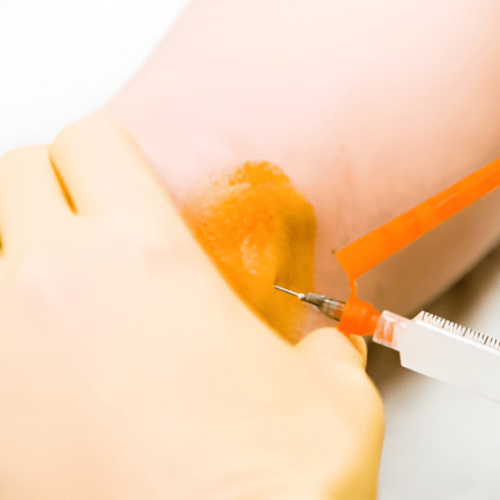 Cortisone Injections Benefits, Risks, and What to Expect Sole Foot Doc foot doctor in Podiatrist Valparaiso IN Valparaiso podiatrist podiatrist Valparaiso Indiana podiatrist Valparaiso