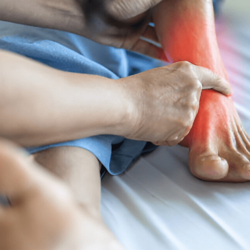 Do Stress Fractures Heal On Their Own Sole Foot and Ankle Sole Foot Doc Podiatrist Valparaiso IN