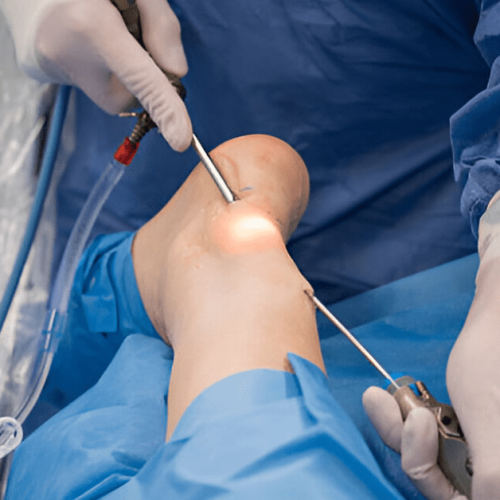 Types of Foot and Ankle Surgeries You Should Know About Sole Foot and Ankle Sole Foot Doc foot doctor in Podiatrist Valparaiso IN